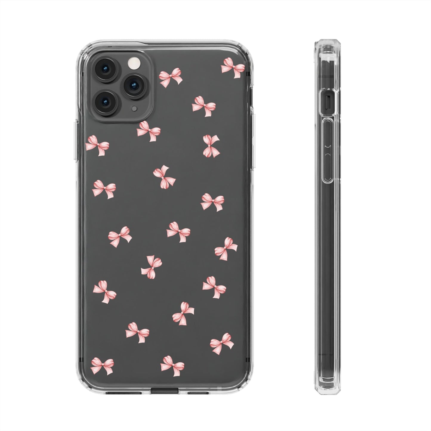 Pink Bow Dreams Clear Phone Case – Stylish Protection for Your iPhone