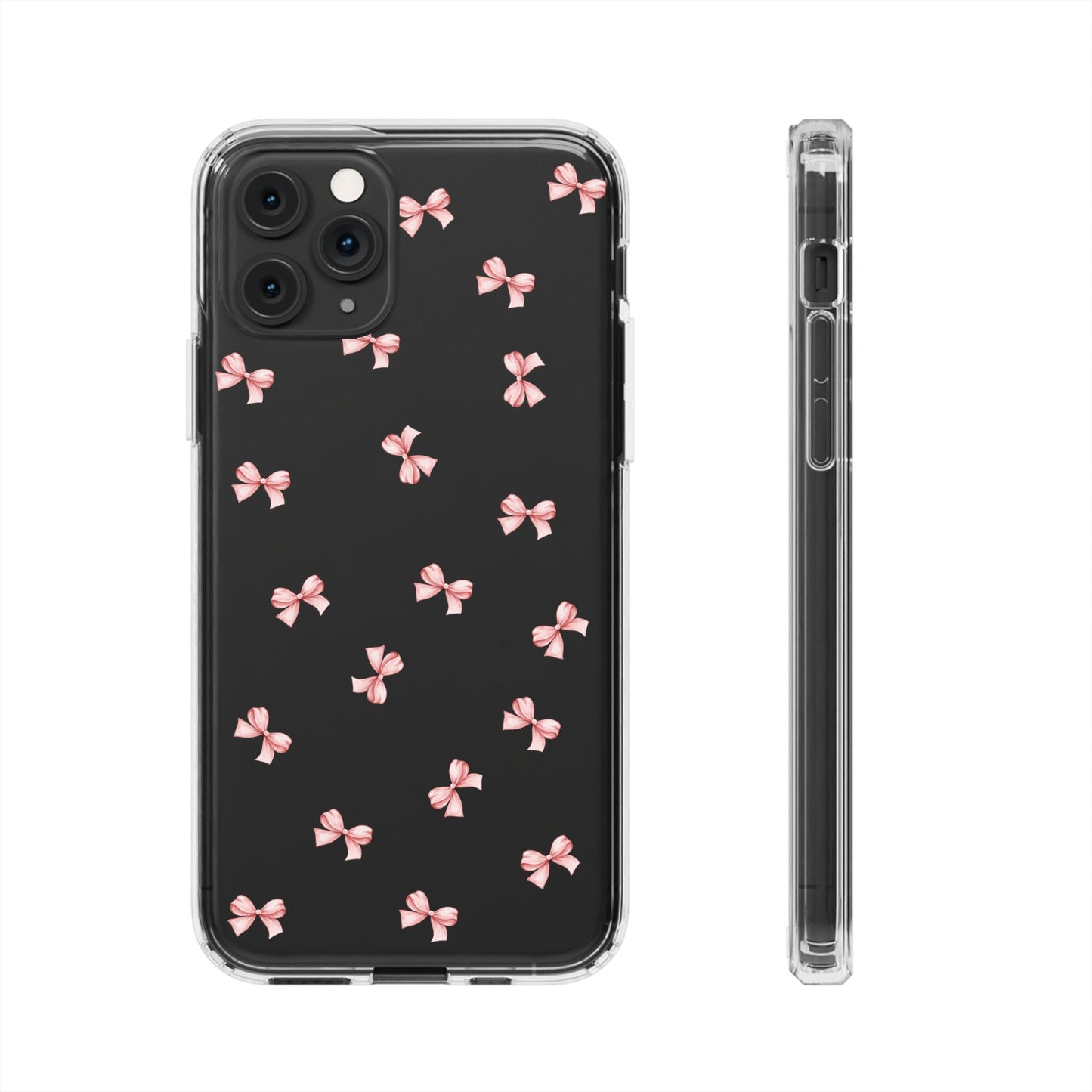 Pink Bow Dreams Clear Phone Case – Stylish Protection for Your iPhone