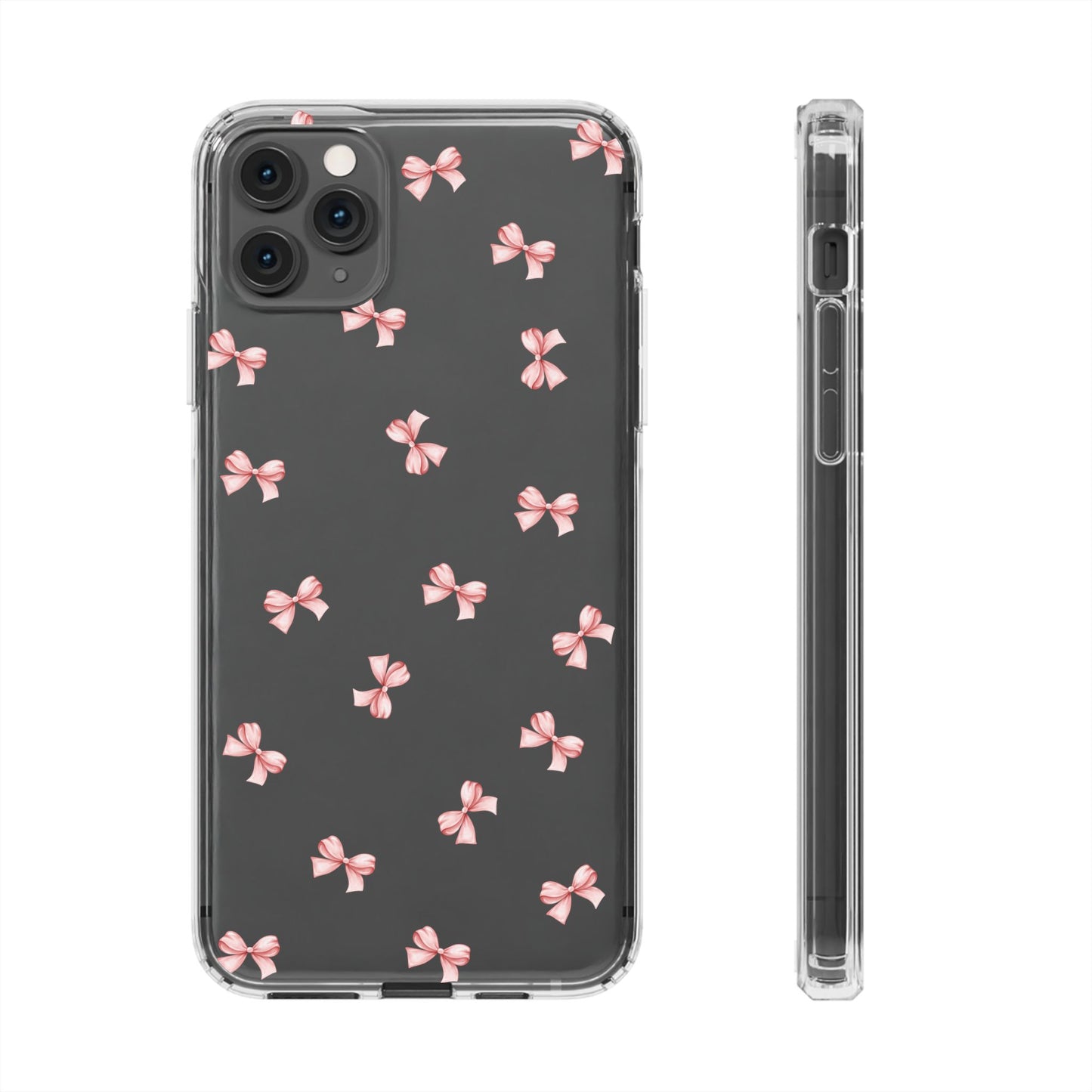 Pink Bow Dreams Clear Phone Case